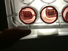 Implantes creados a partir de tu sangre podrían reparar huesos rotos Una muestra en un laboratorio que muestra placas de cultivo con estructuras impresas en 3D sumergidas en sangre o un medio similar, iluminadas desde el fondo. Las estructuras parecen diseñadas para experimentos de regeneración ósea o tejidos.